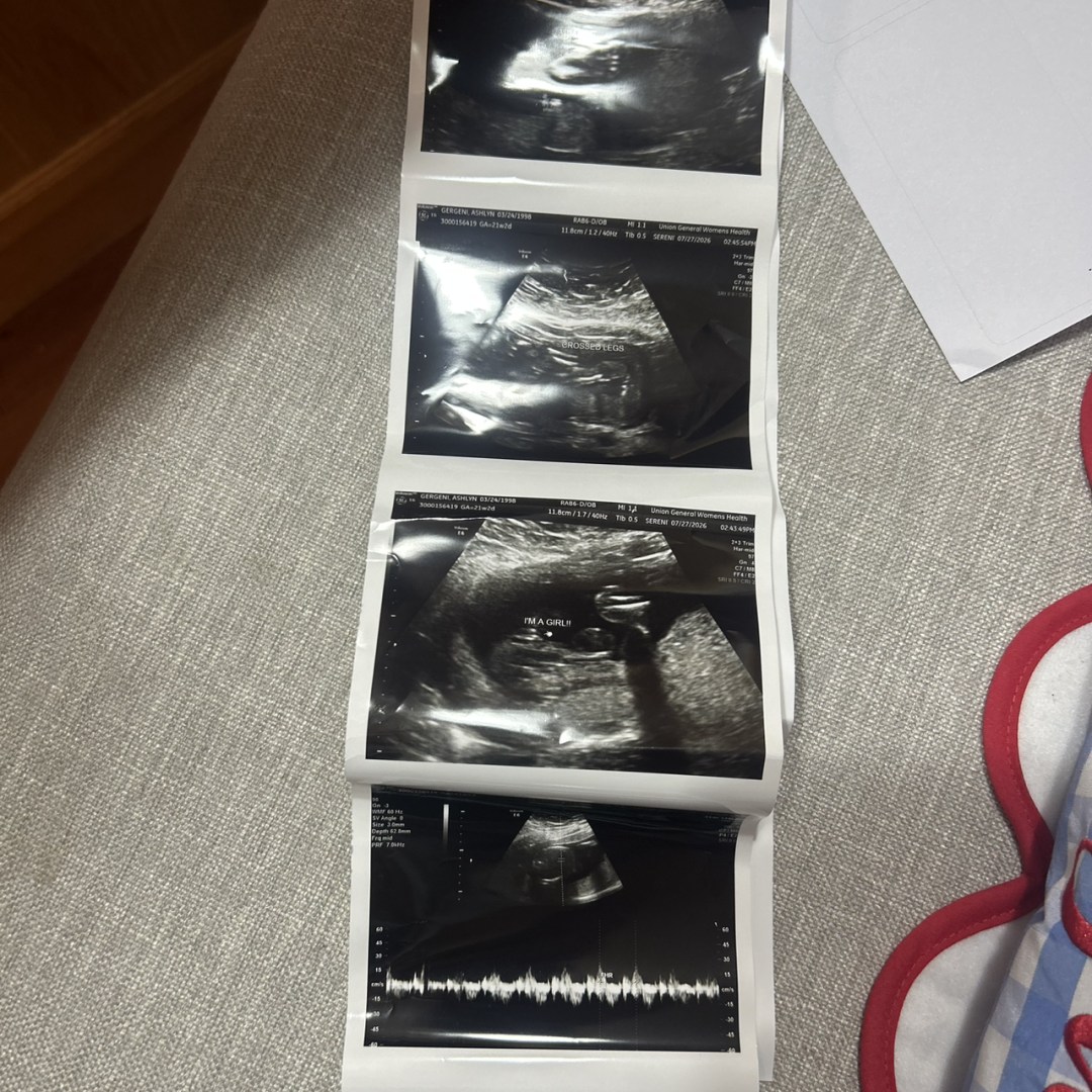 Photo shared by Ashlyn for their Babylist baby registry.