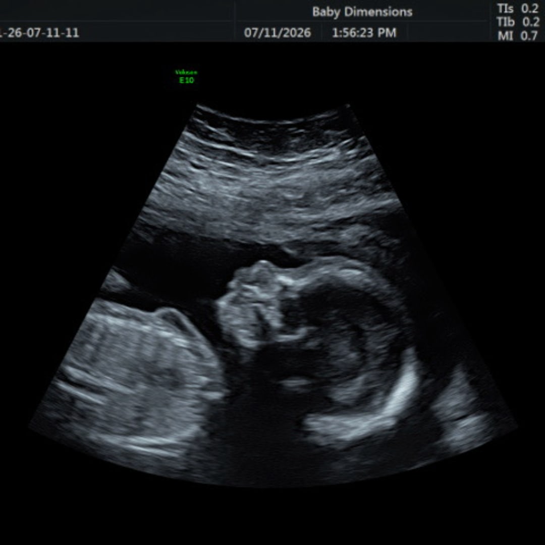 Photo shared by Anna for their Babylist baby registry.