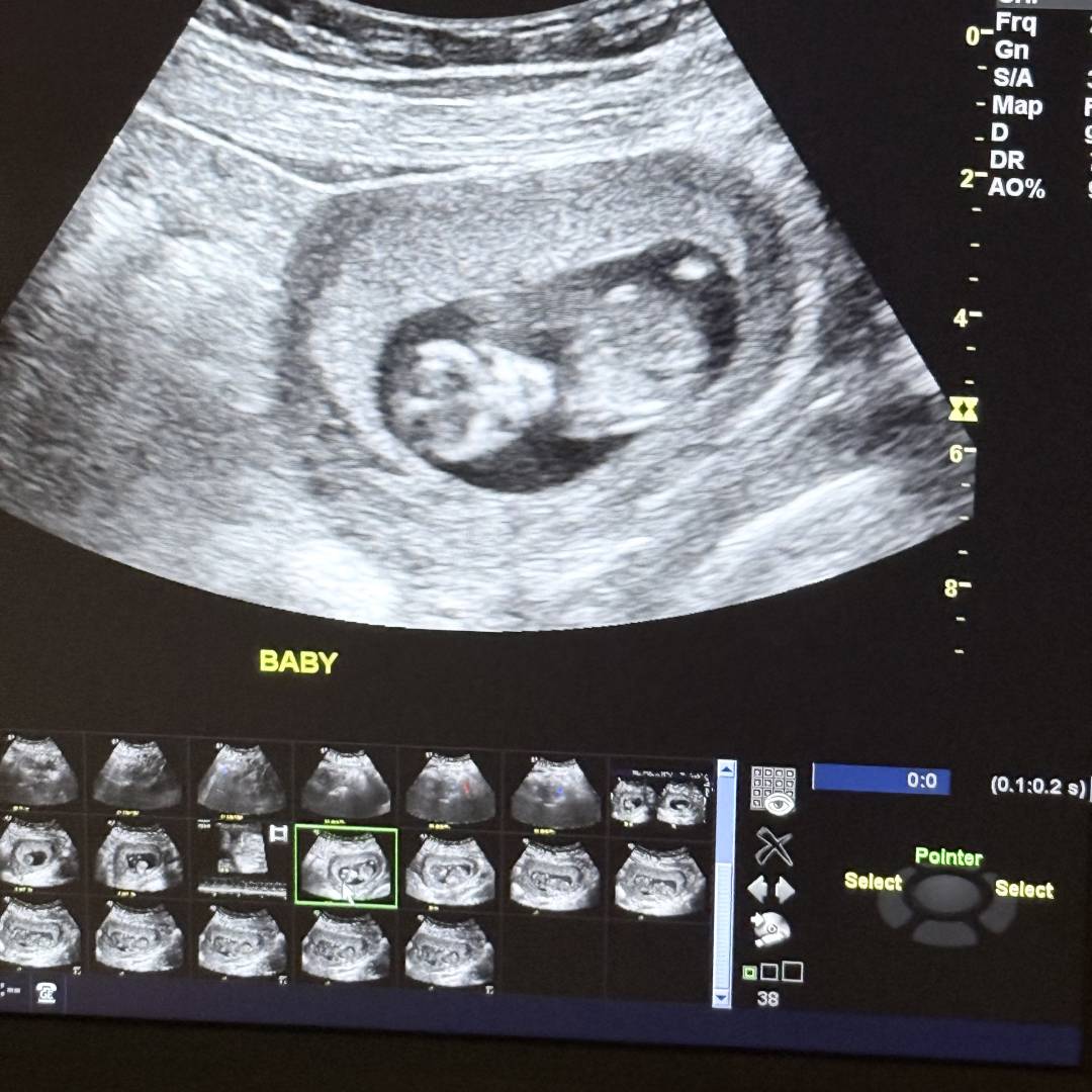 Photo shared by Karina for their Babylist baby registry.