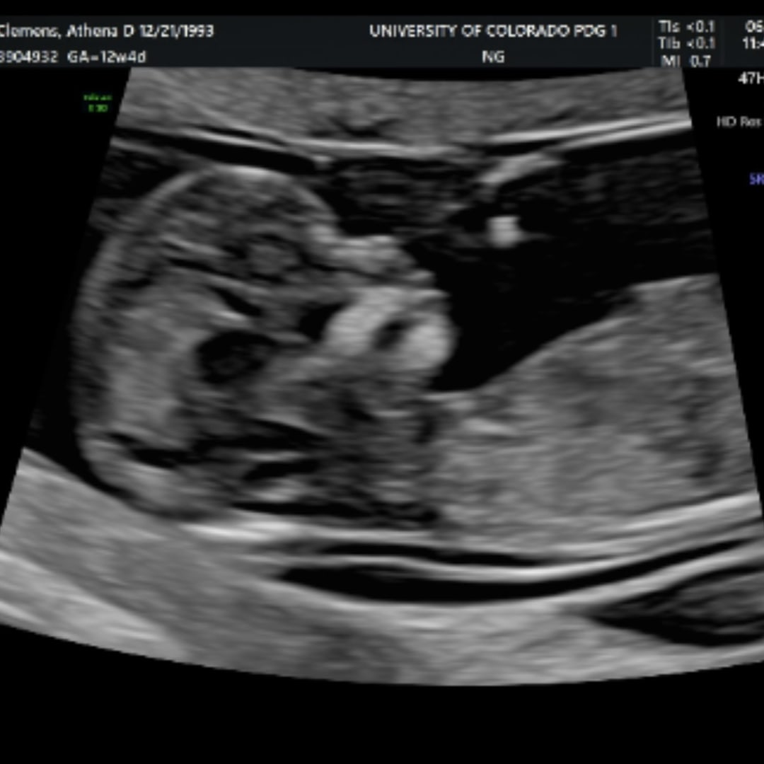 Photo shared by Athena and Michael for their Babylist baby registry.