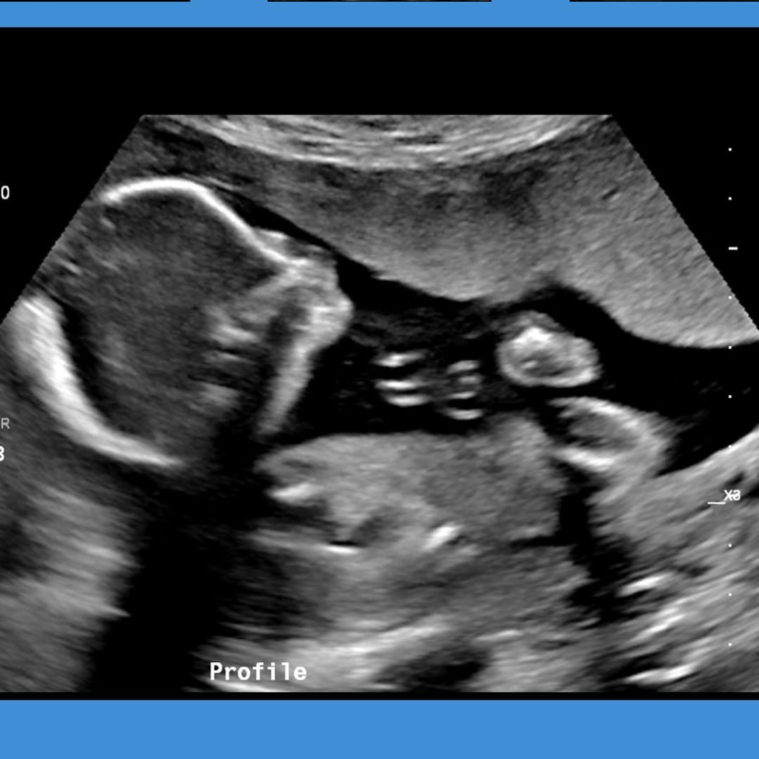 Photo shared by Morgan for their Babylist baby registry.