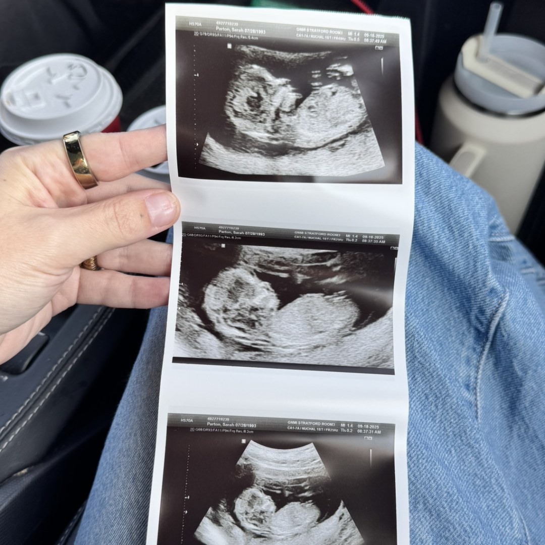 Photo shared by Sarah for their Babylist baby registry.