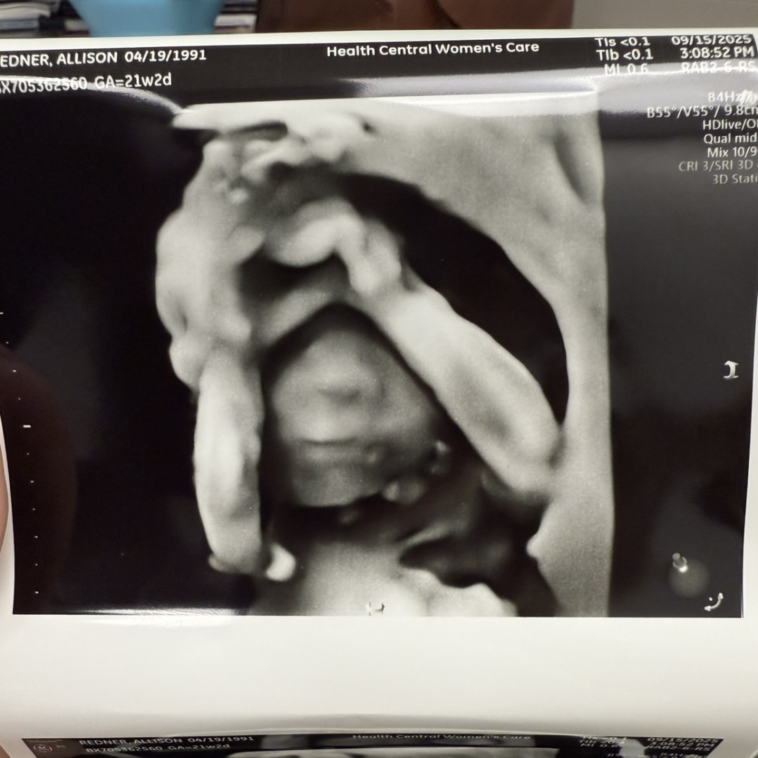 Photo shared by Allison for their Babylist baby registry.