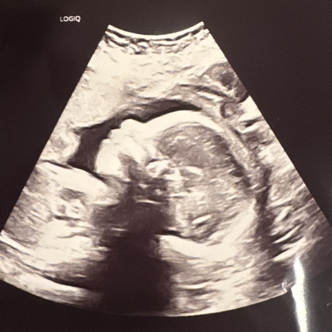 Photo shared by Maryam for their Babylist baby registry.