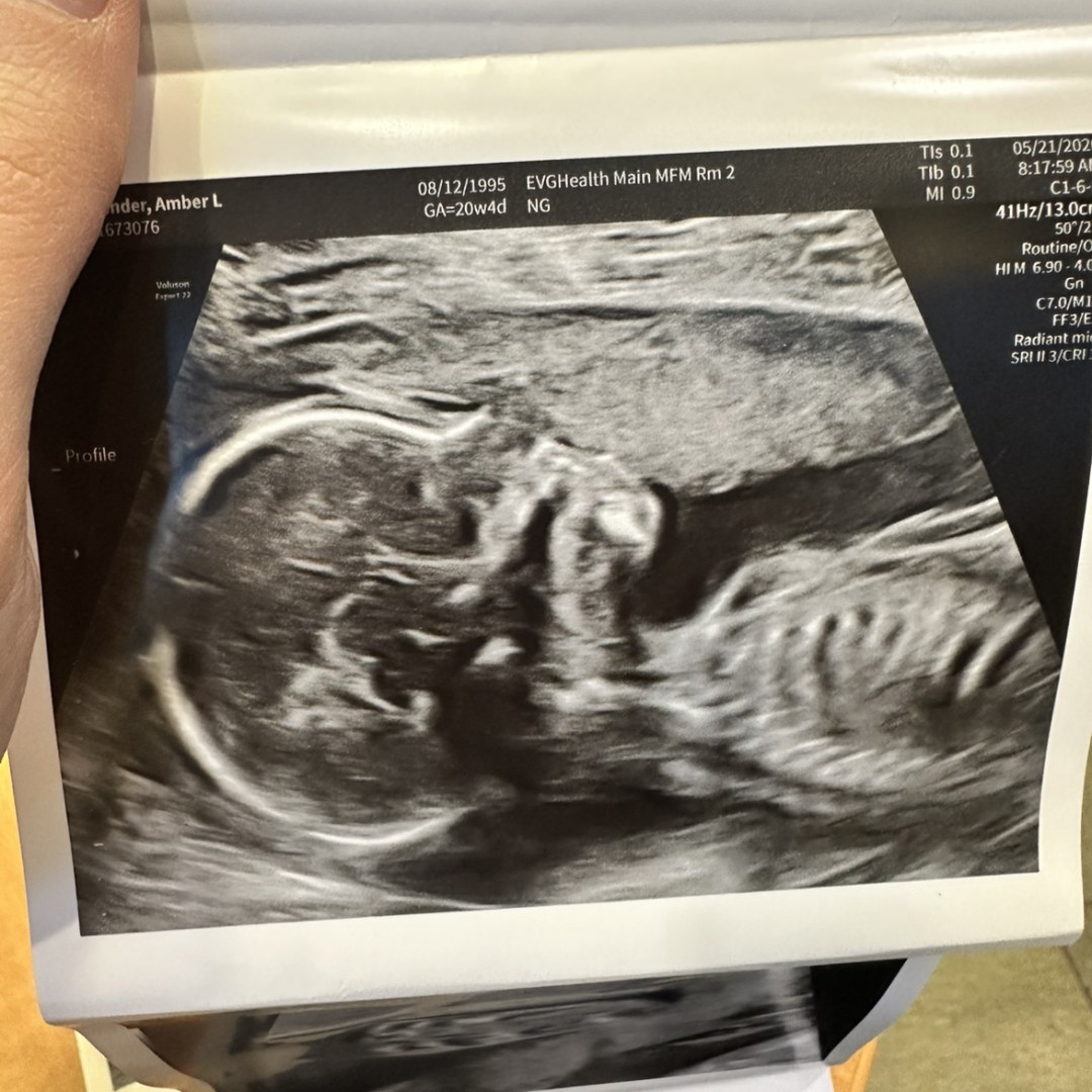 Photo shared by Amber for their Babylist baby registry.