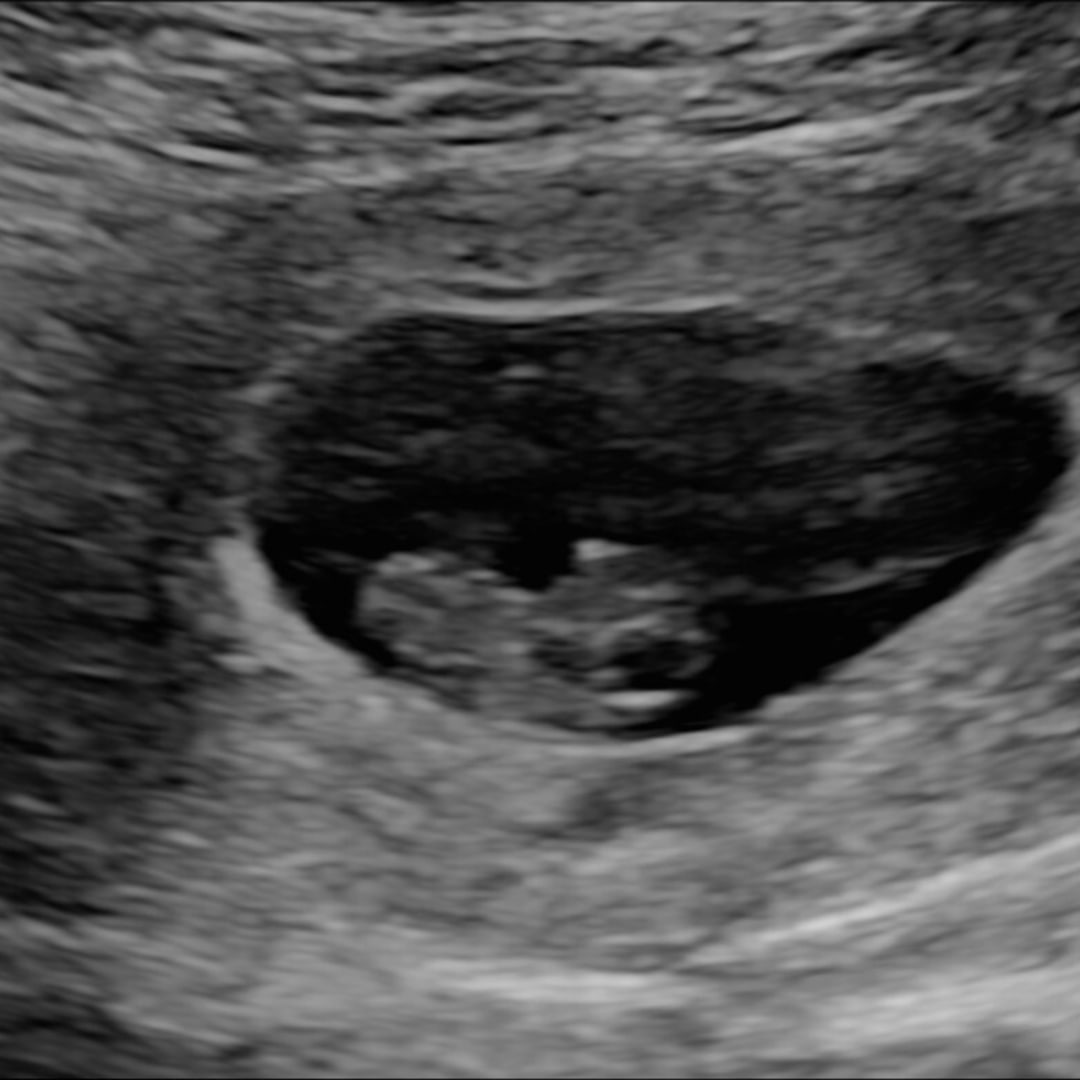 Photo shared by Caroline for their Babylist baby registry.
