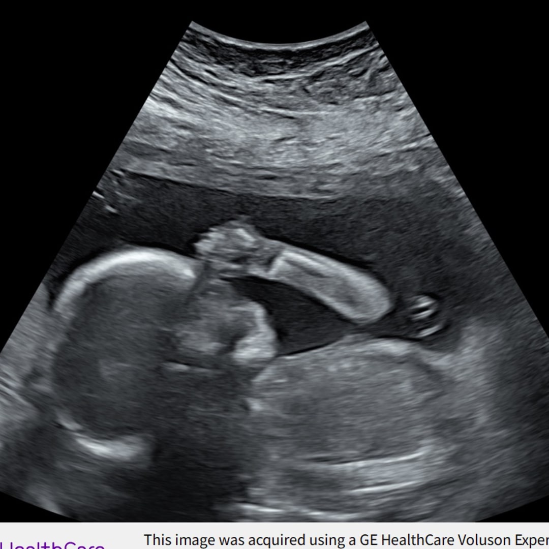 Photo shared by Nermean for their Babylist baby registry.