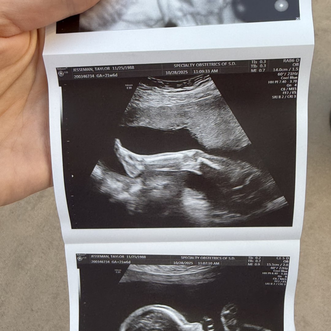 Photo shared by Taylor for their Babylist baby registry.