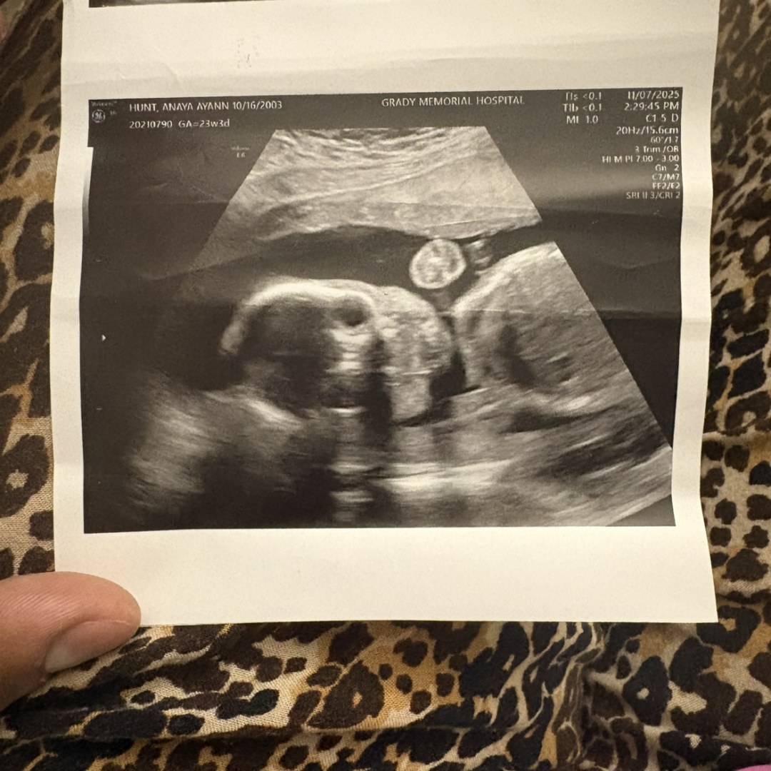 Photo shared by Anaya for their Babylist baby registry.