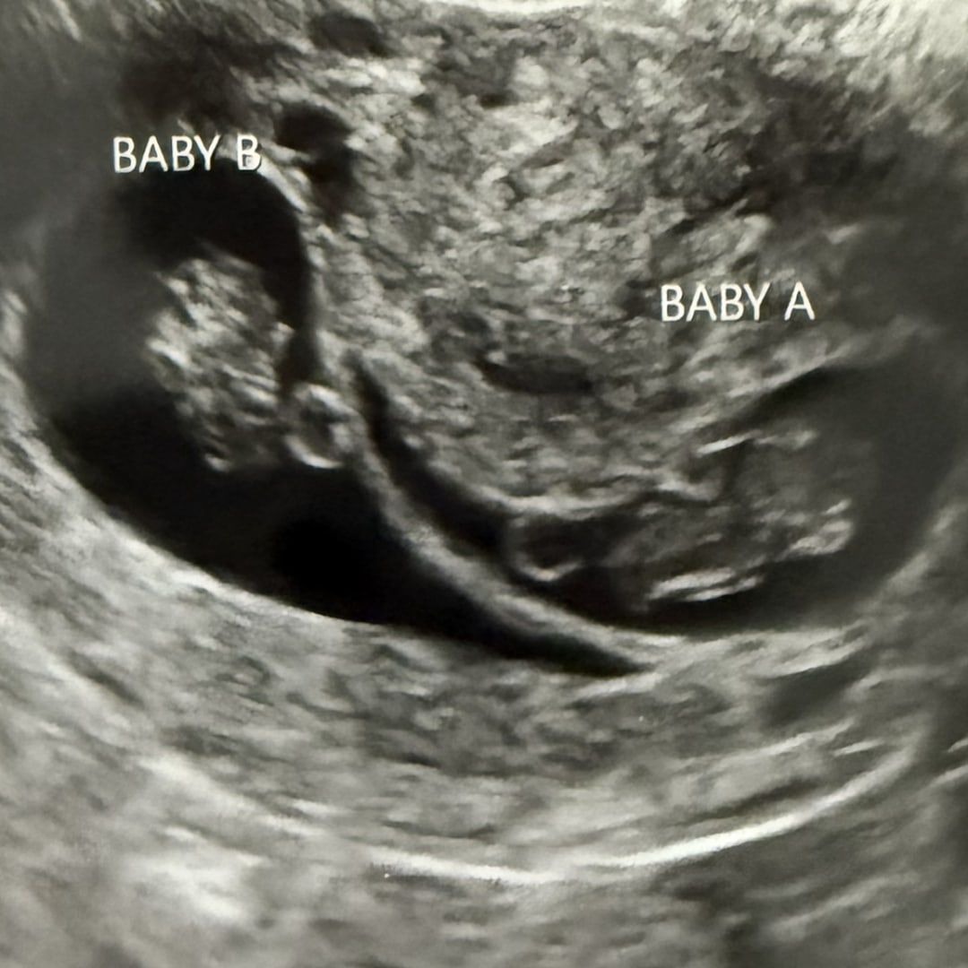Photo shared by McCrea for their Babylist baby registry.