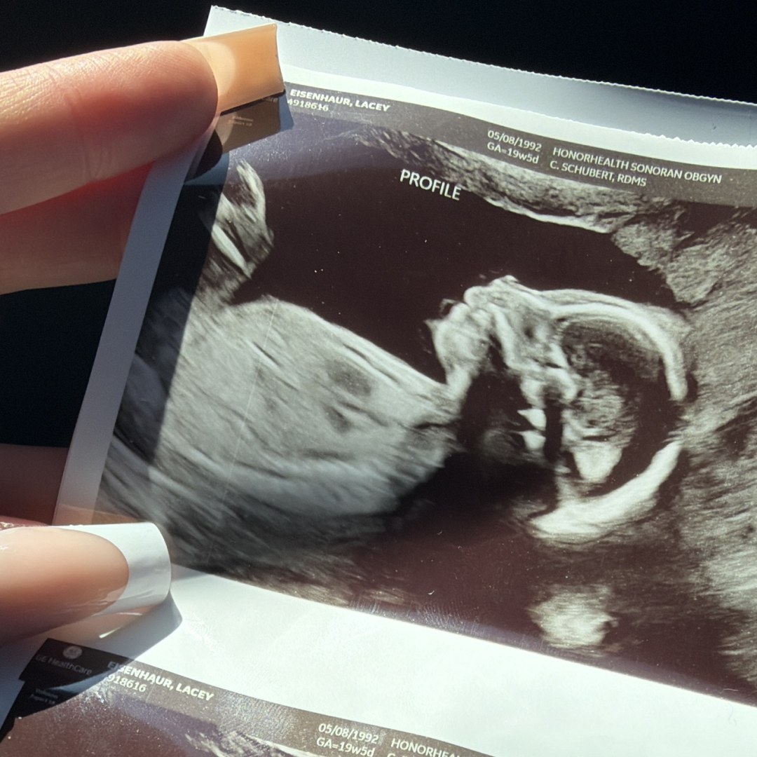 Photo shared by Lacey for their Babylist baby registry.