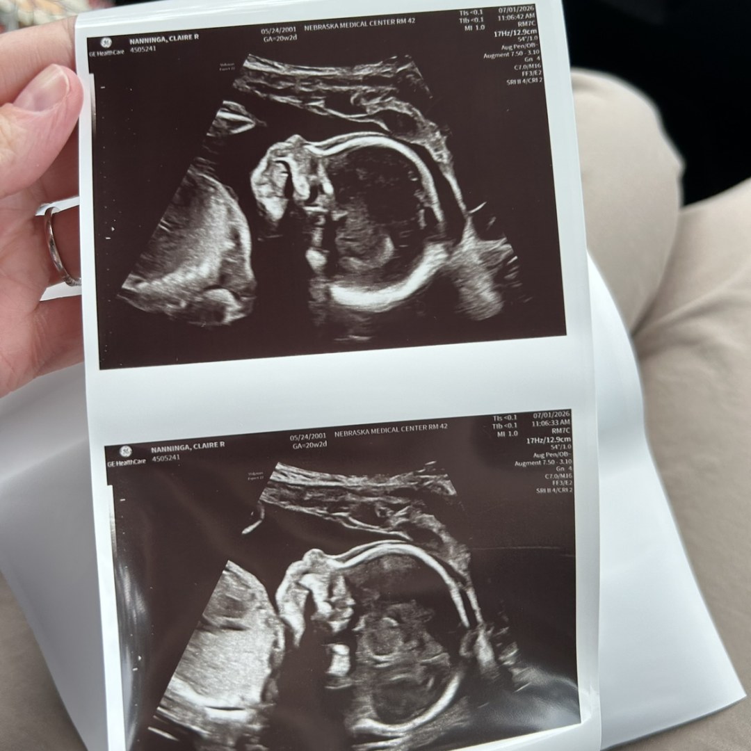 Photo shared by Claire for their Babylist baby registry.