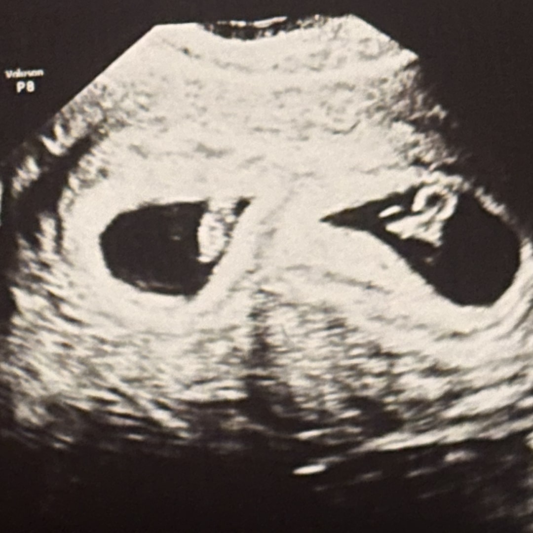 Photo shared by Alyssa for their Babylist baby registry.