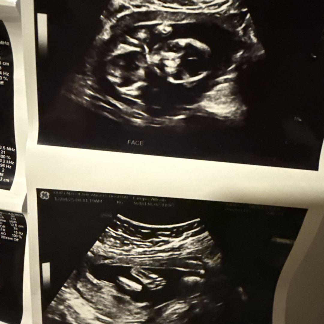 Photo shared by Allison for their Babylist baby registry.