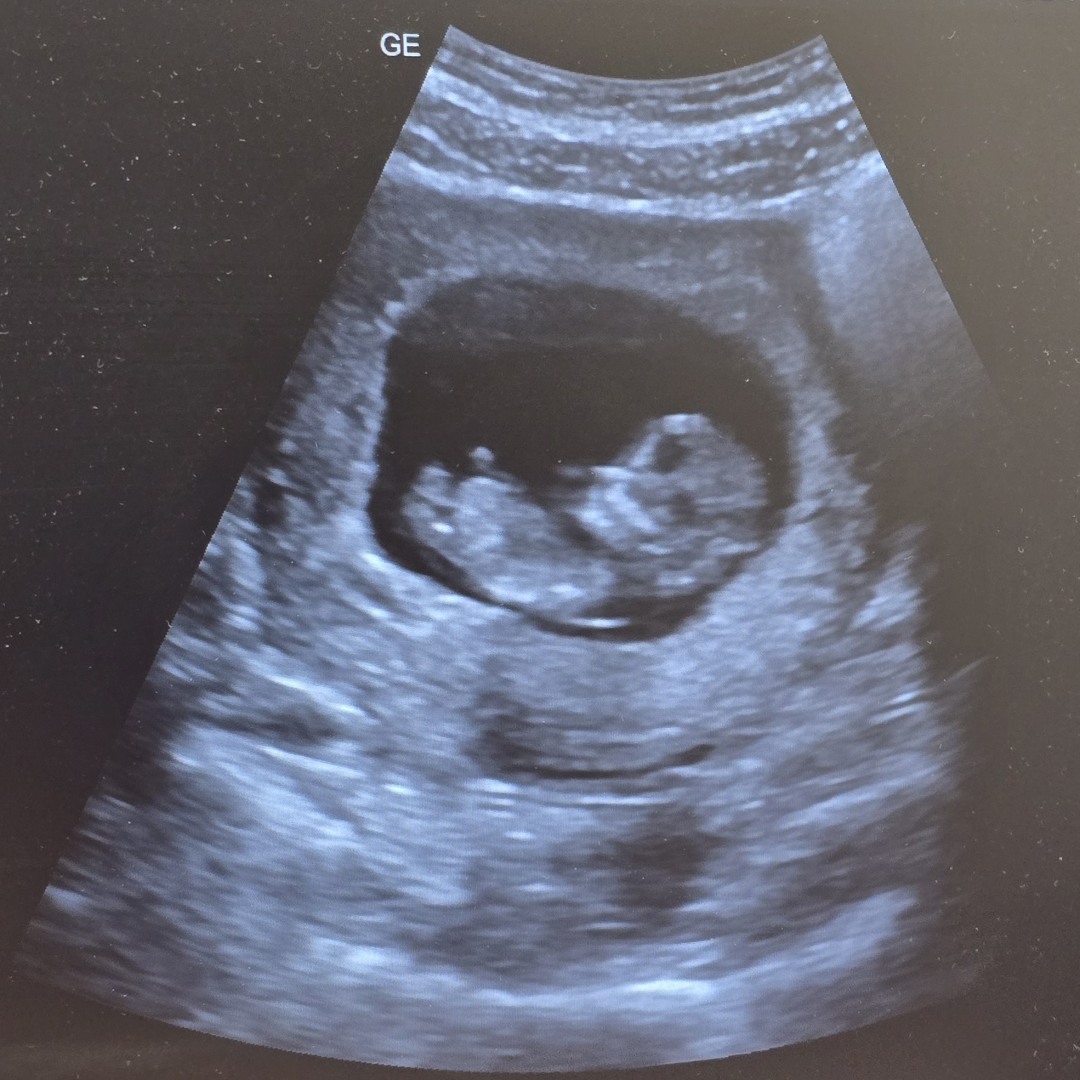 Photo shared by McKinnon for their Babylist baby registry.