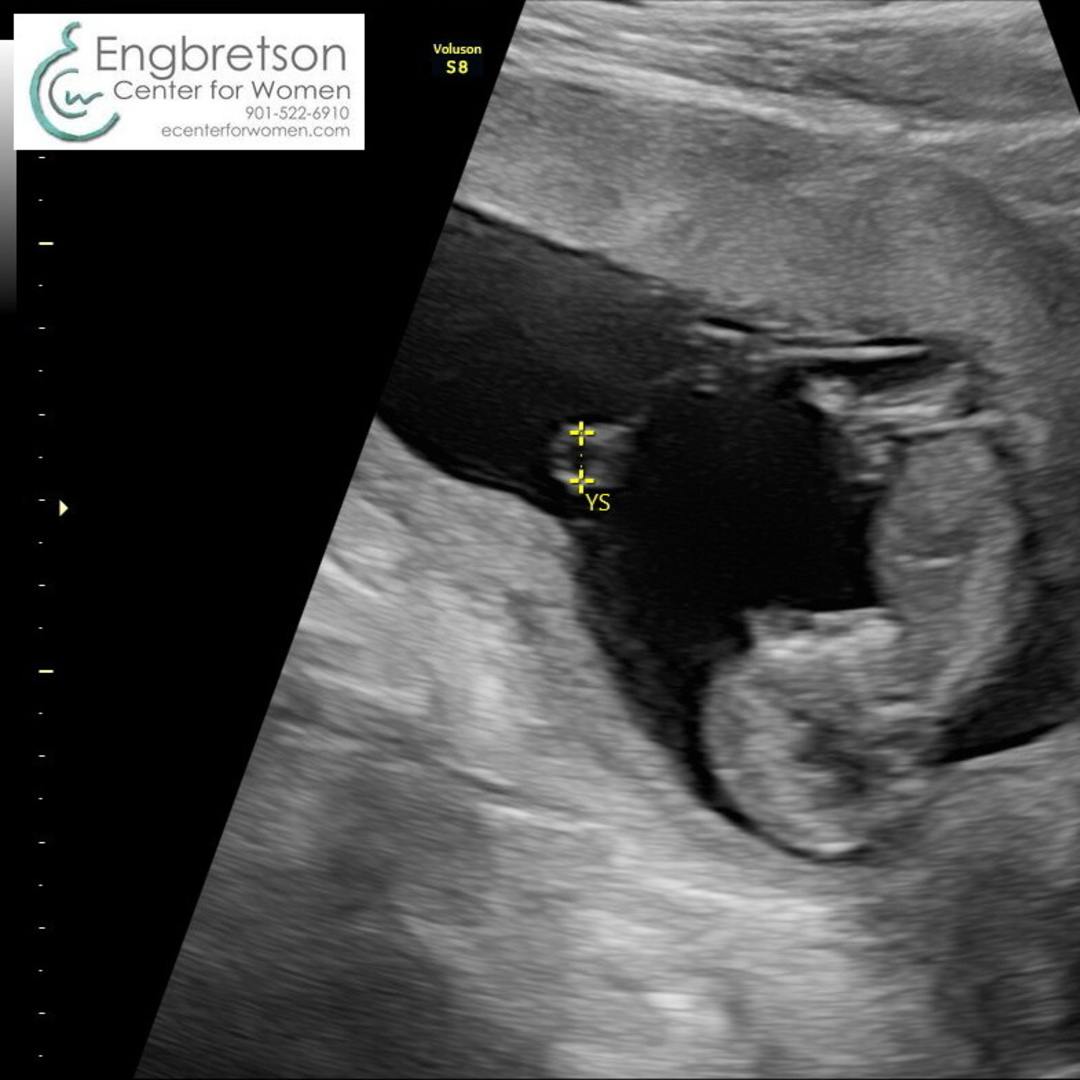 Photo shared by Emma for their Babylist baby registry.