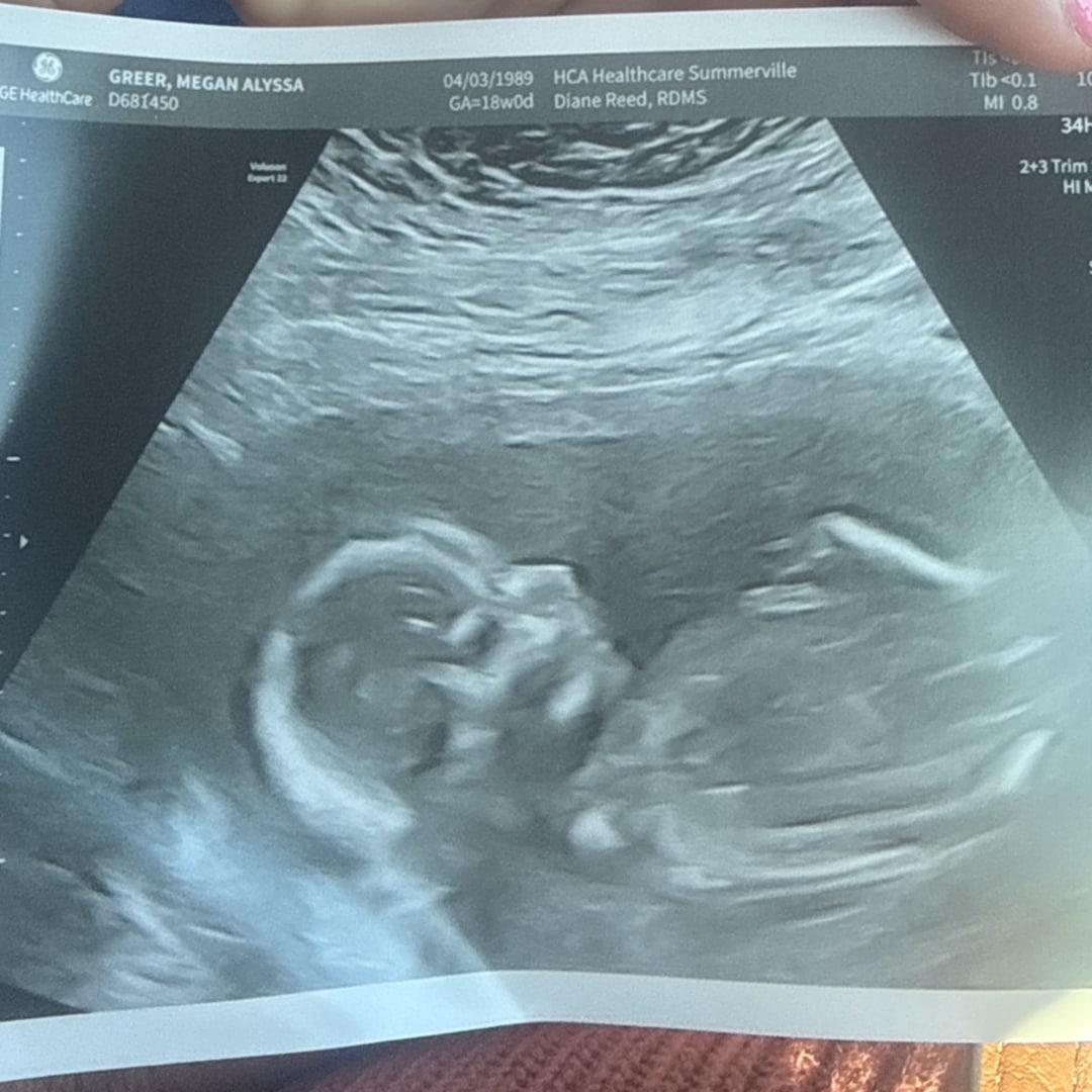 Photo shared by Megan for their Babylist baby registry.