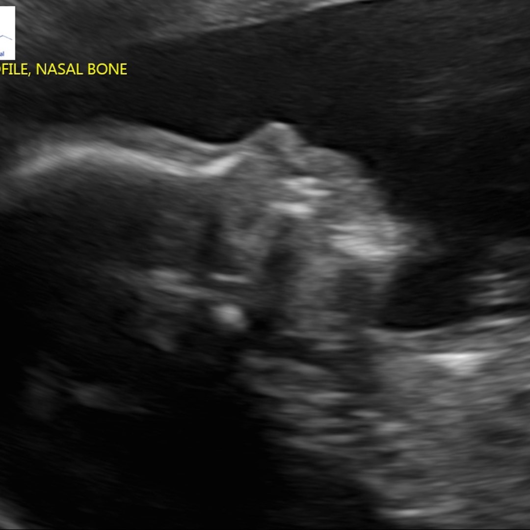 Photo shared by Sarah for their Babylist baby registry.