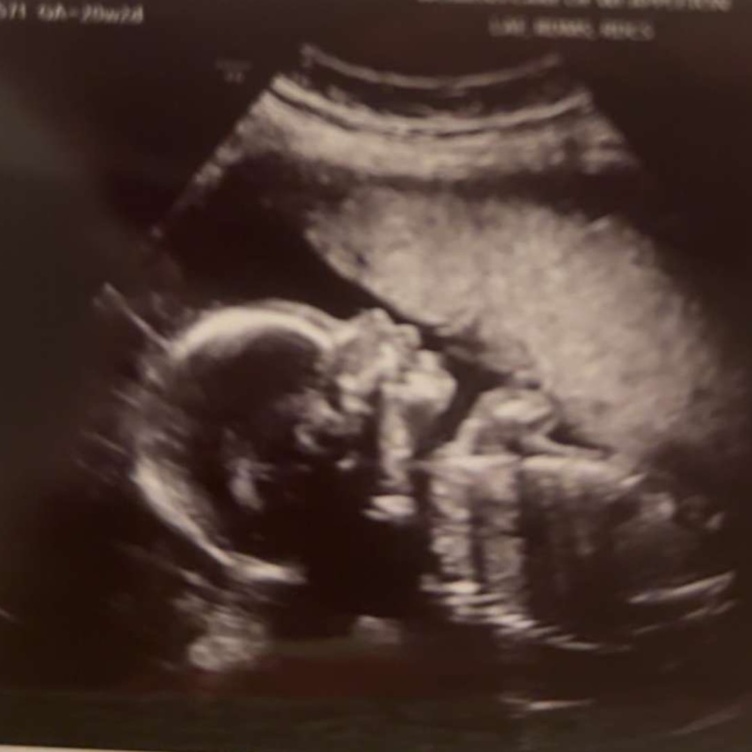Photo shared by Morgan for their Babylist baby registry.