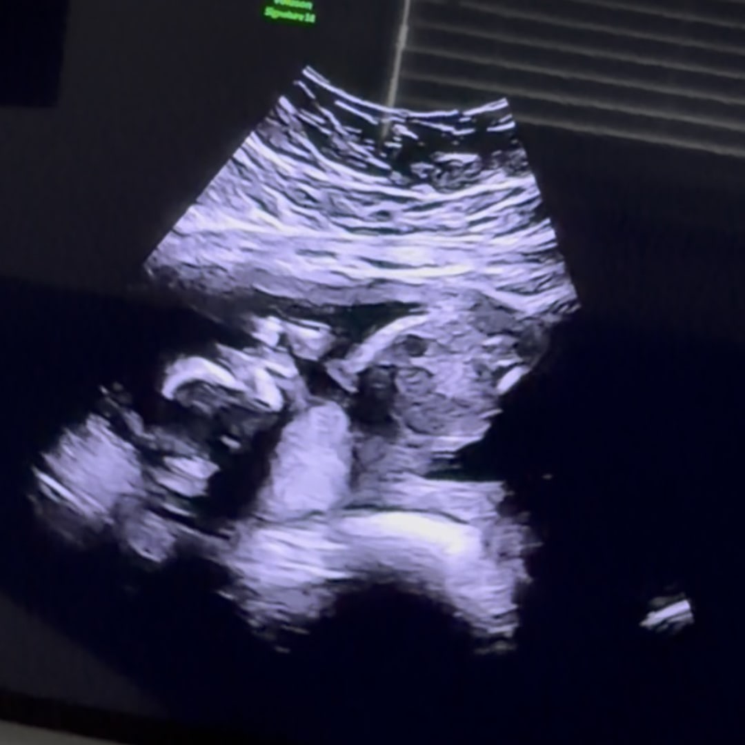 Photo shared by Amber for their Babylist baby registry.