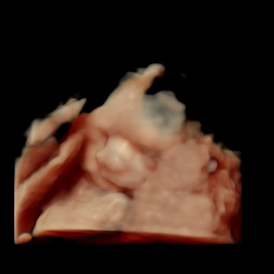 Photo shared by Katherine for their Babylist baby registry.