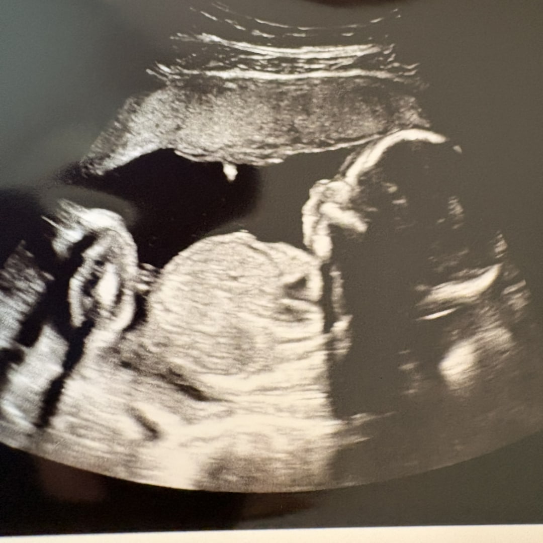 Photo shared by Amaretta for their Babylist baby registry.
