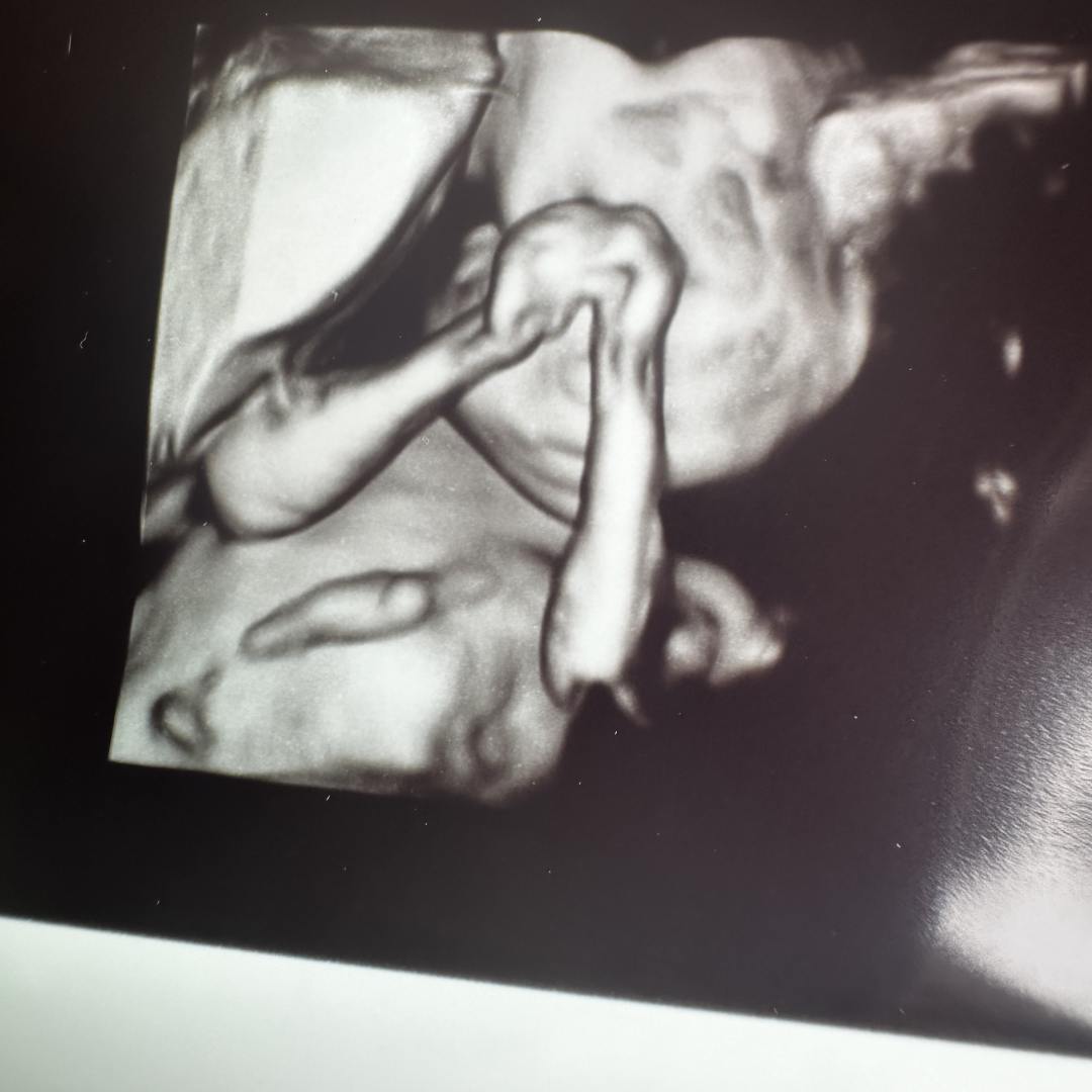 Photo shared by Abigail for their Babylist baby registry.