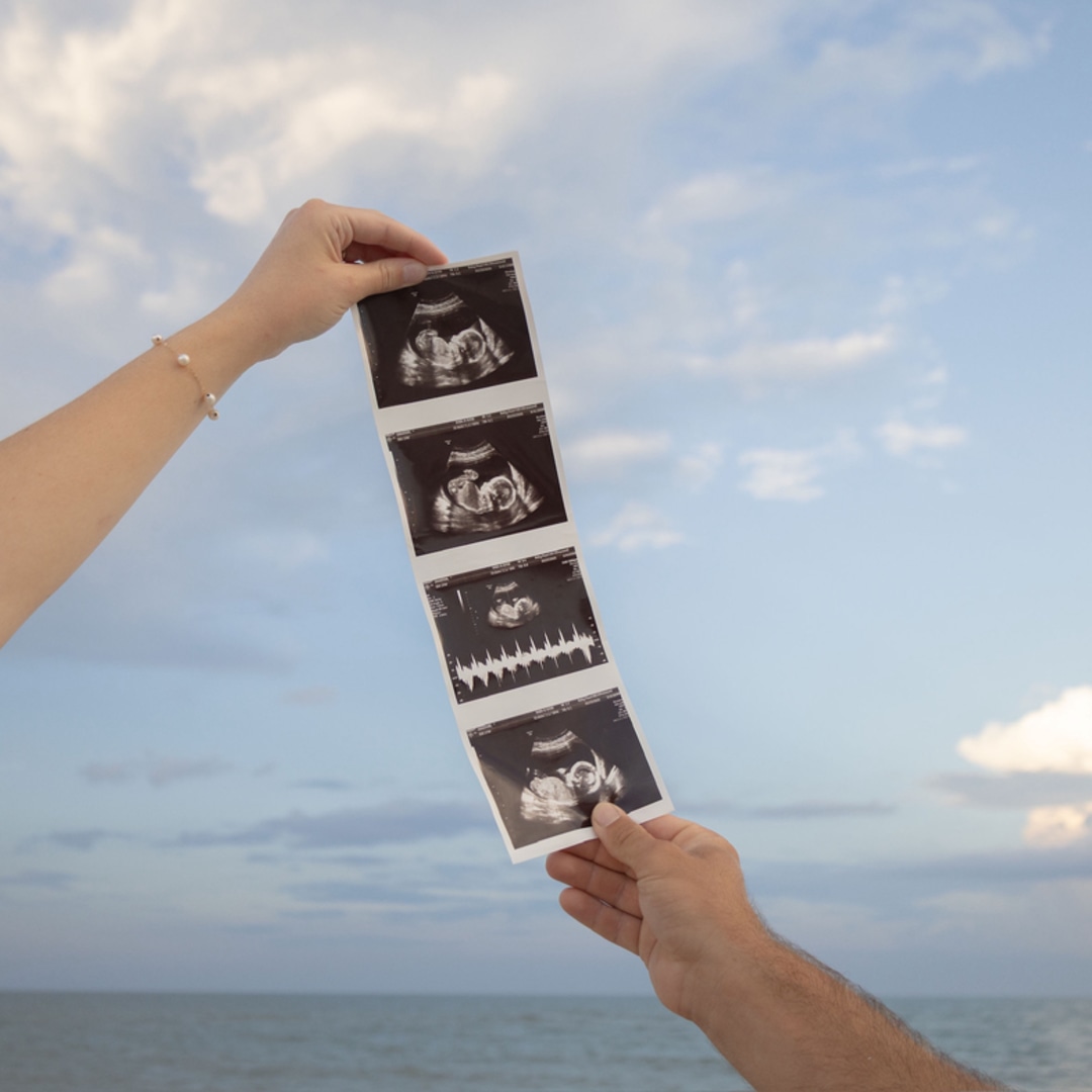 Photo shared by Ida for their Babylist baby registry.