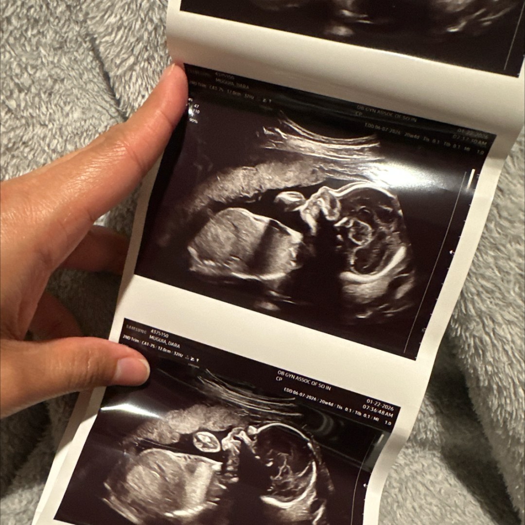 Photo shared by Dara for their Babylist baby registry.