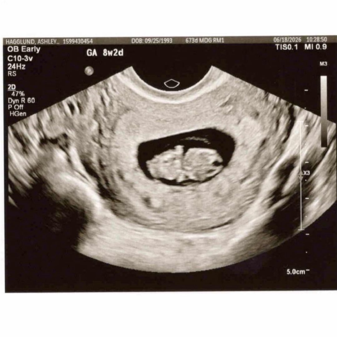 Photo shared by Ashley for their Babylist baby registry.