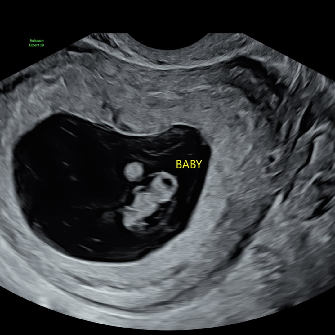 Photo shared by Aaleeyah for their Babylist baby registry.