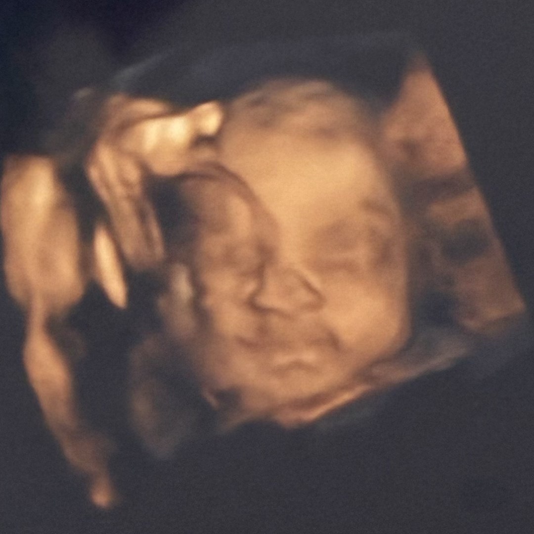 Photo shared by Mya for their Babylist baby registry.