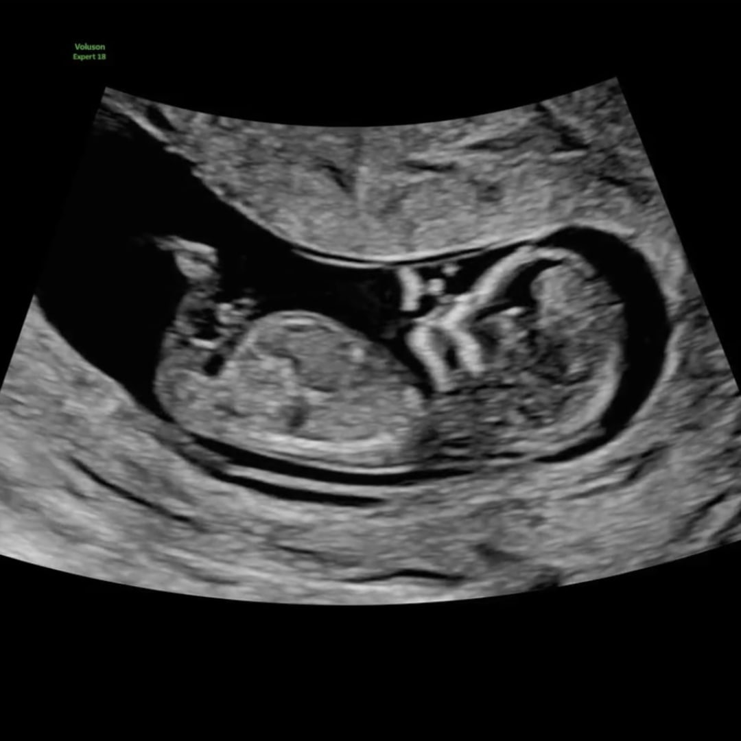 Photo shared by Ella and Zack for their Babylist baby registry.