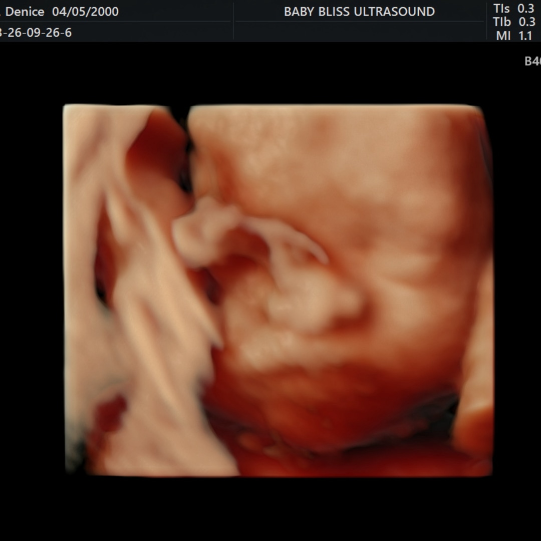 Photo shared by Denice for their Babylist baby registry.