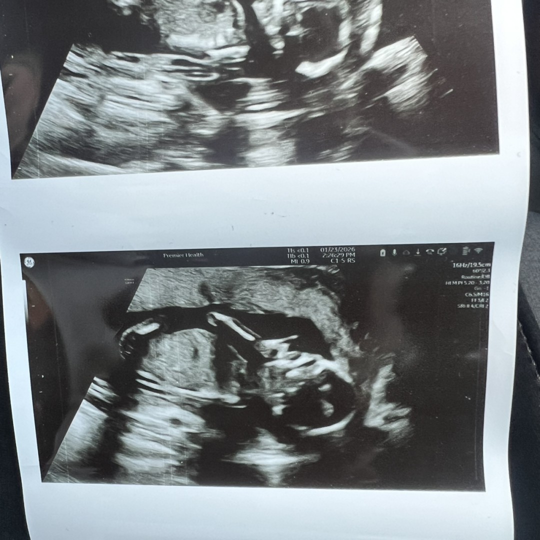 Photo shared by Cecily for their Babylist baby registry.