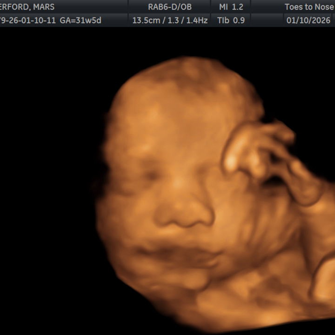 Photo shared by Mars for their Babylist baby registry.