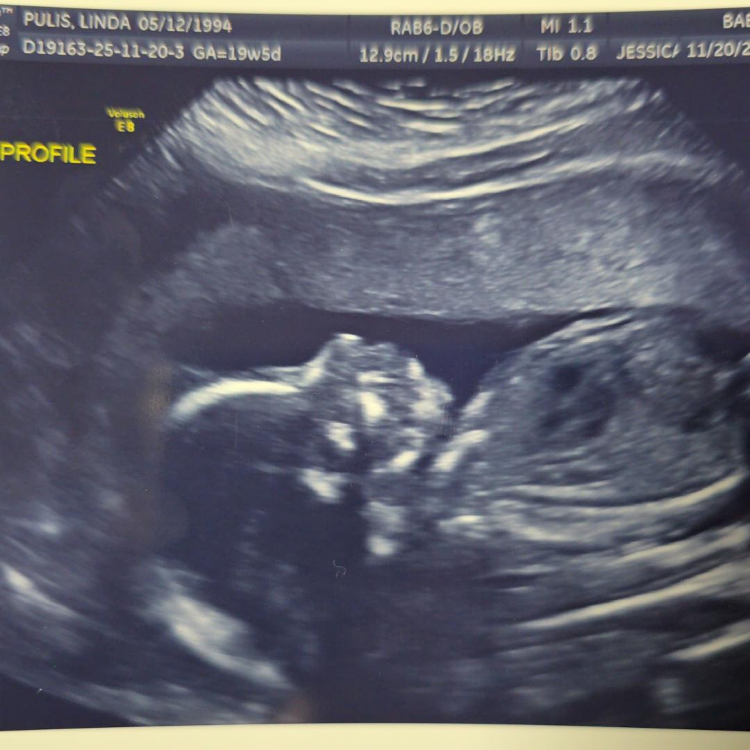 Photo shared by Linda for their Babylist baby registry.