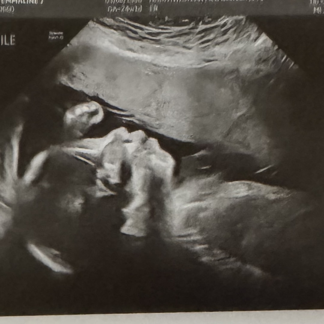 Photo shared by Emmaline for their Babylist baby registry.