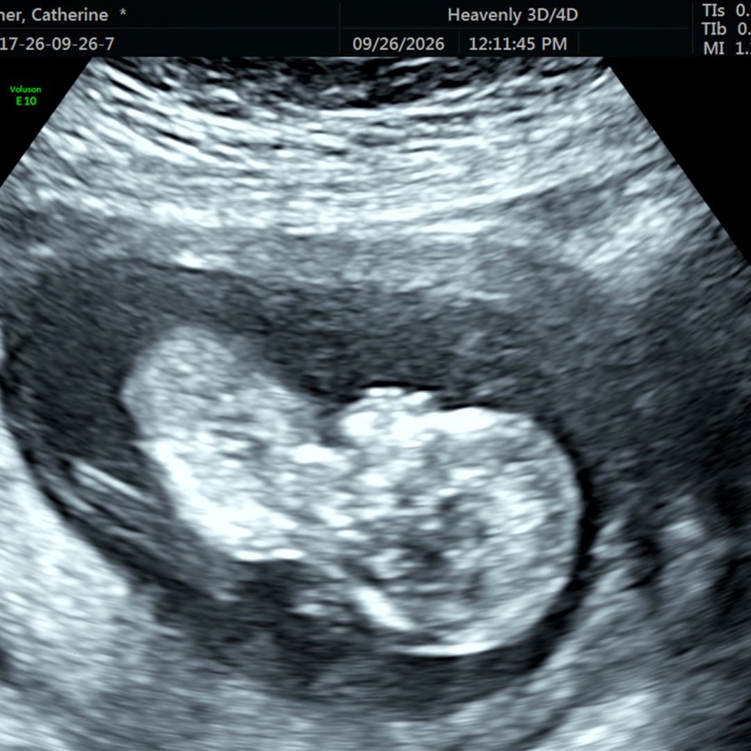 Photo shared by Catherine for their Babylist baby registry.