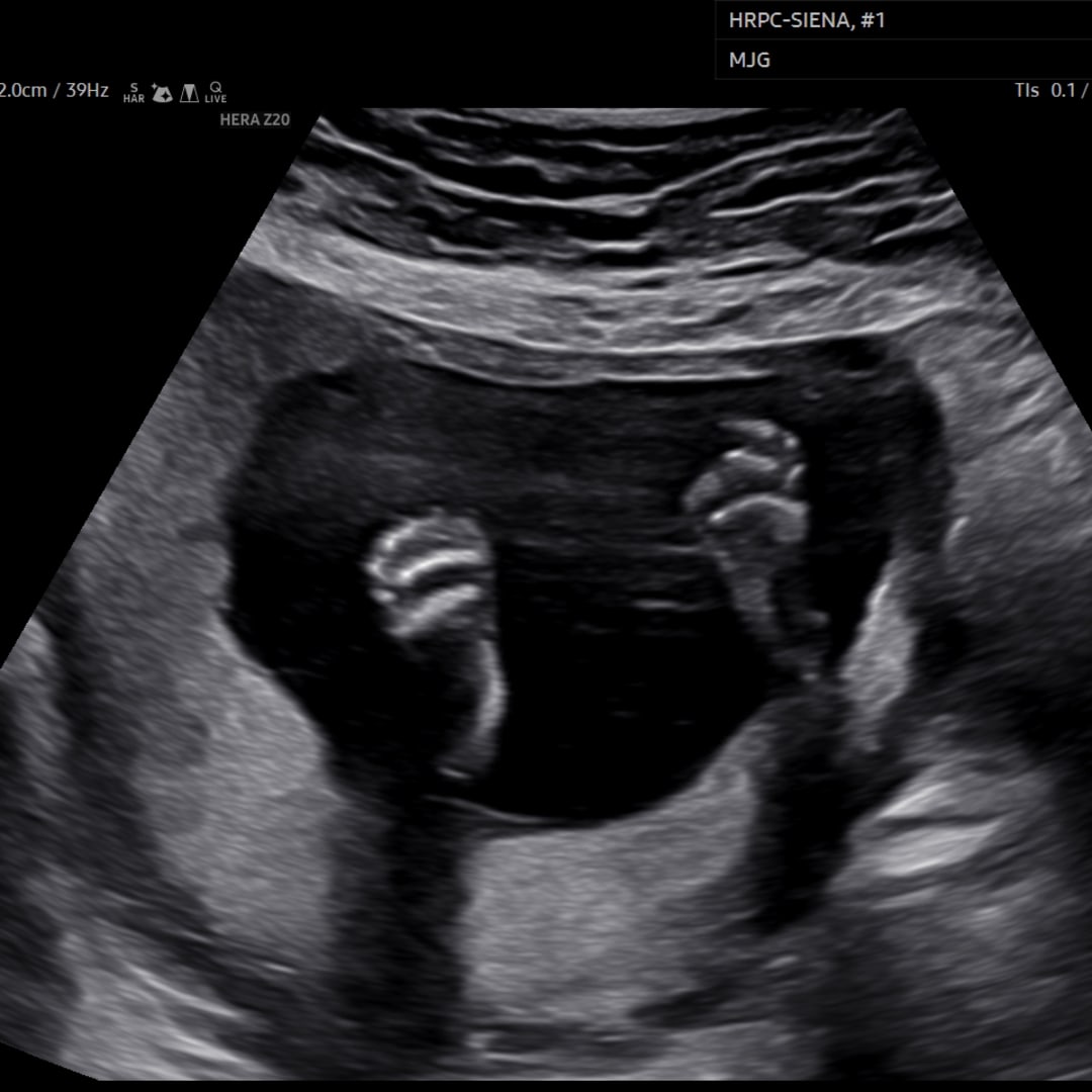 Photo shared by Stephanie for their Babylist baby registry.