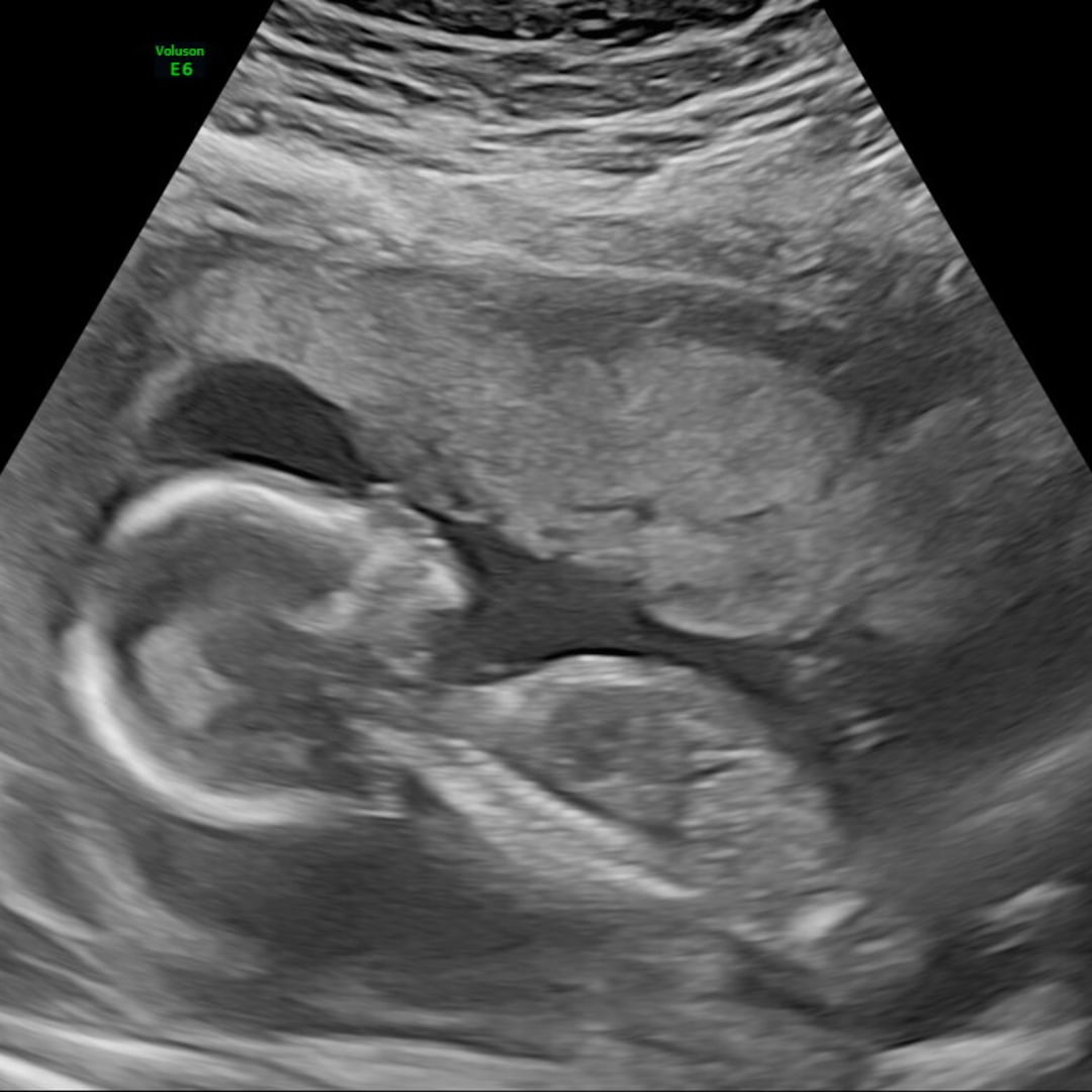 Photo shared by Alyssa for their Babylist baby registry.