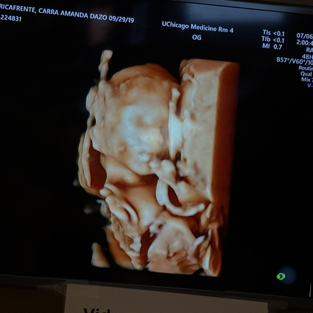Photo shared by Amanda for their Babylist baby registry.