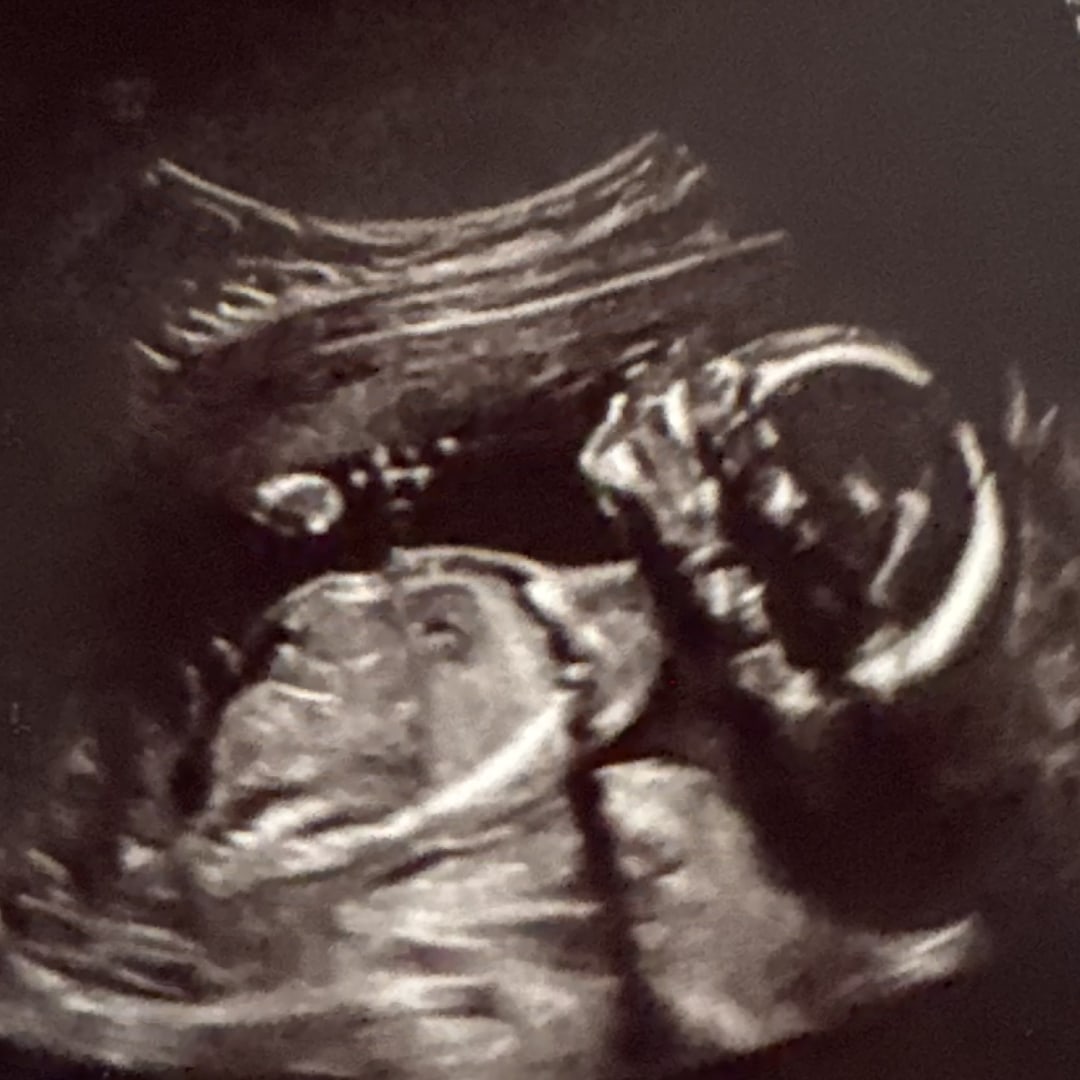 Photo shared by Madisyn for their Babylist baby registry.