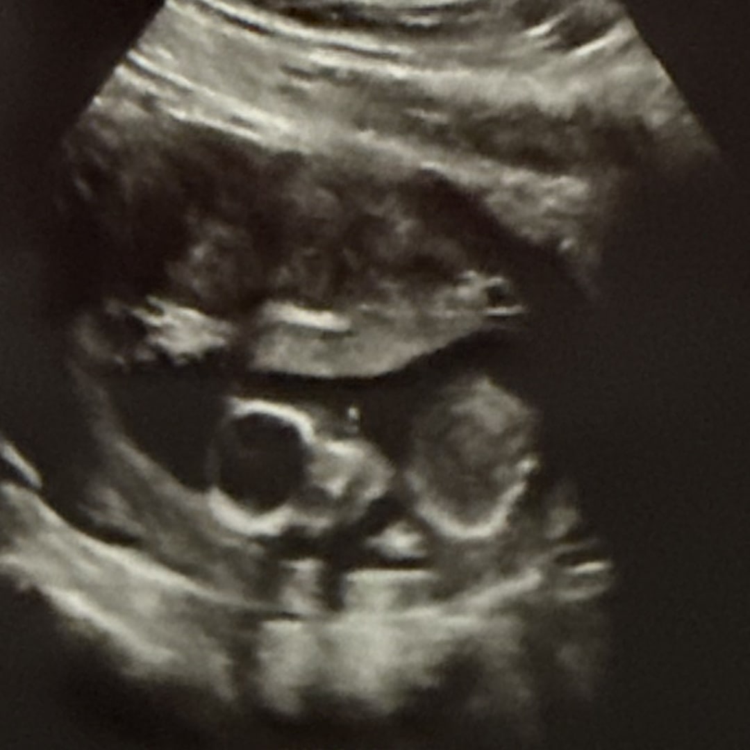 Photo shared by Eleanor for their Babylist baby registry.