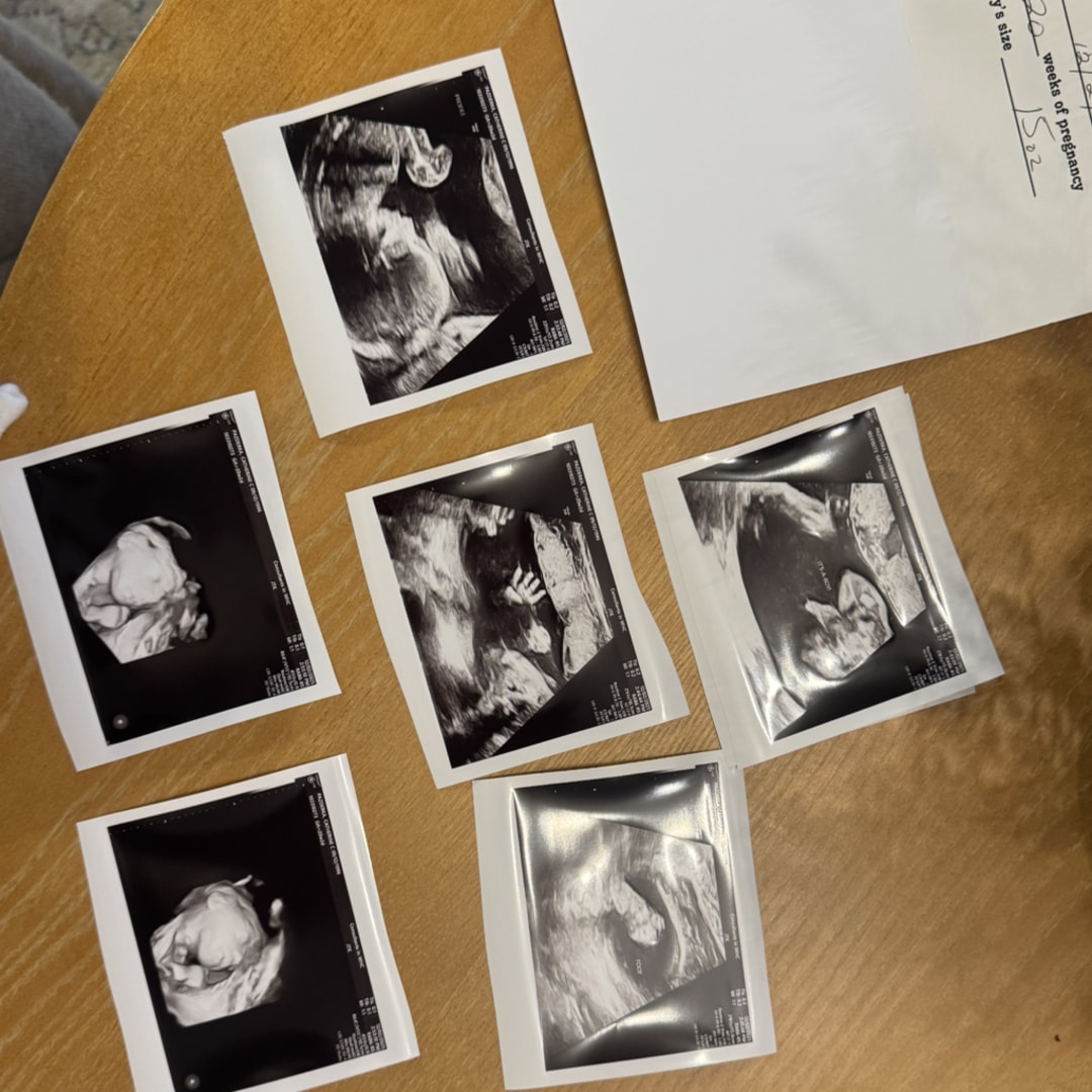 Photo shared by Catherine for their Babylist baby registry.