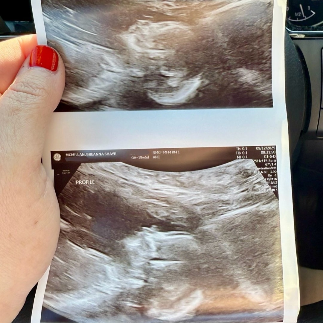Photo shared by Breanna for their Babylist baby registry.
