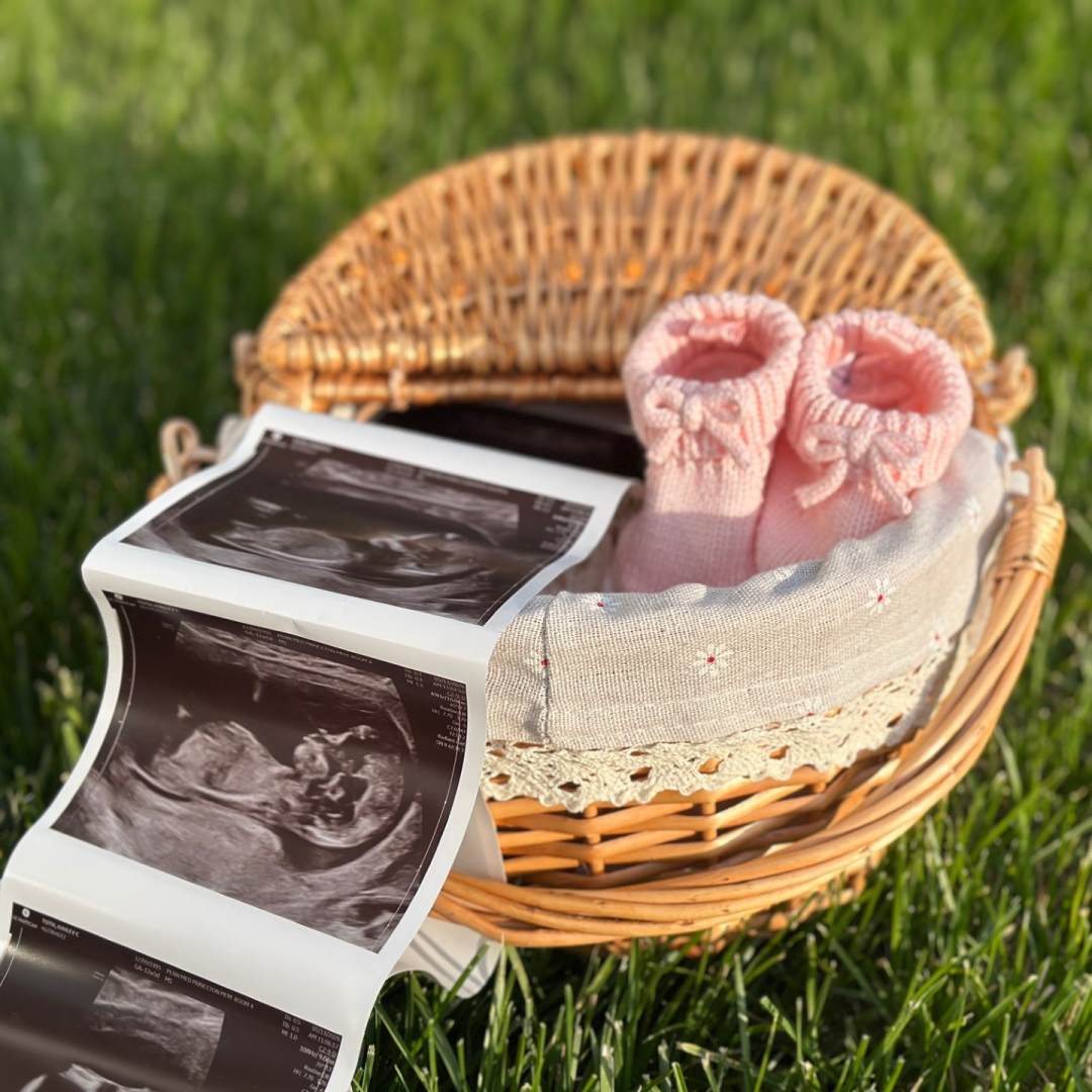 Photo shared by Hailey for their Babylist baby registry.