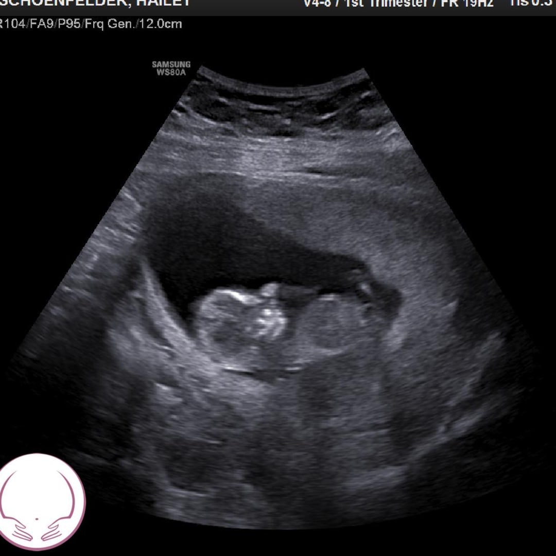 Photo shared by Hailey for their Babylist baby registry.