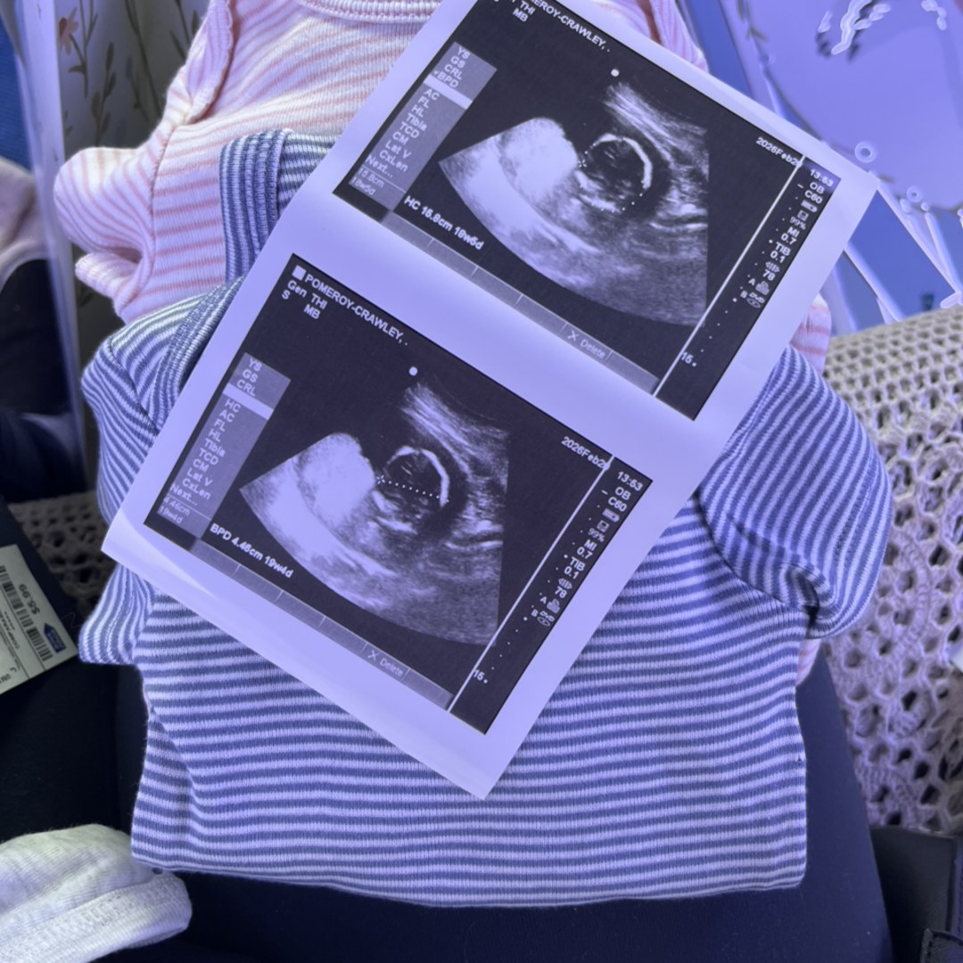 Photo shared by Shannon for their Babylist baby registry.