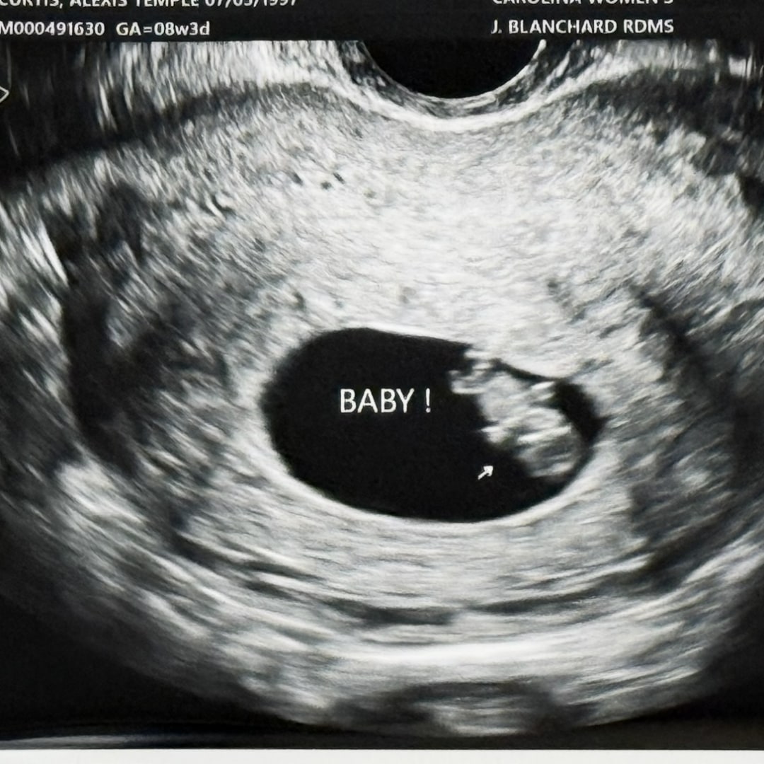 Photo shared by Alexis for their Babylist baby registry.